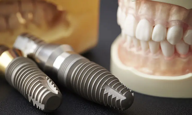 無痛のインプラント | 東京・港区の歯医者