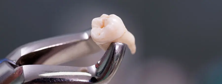 歯を失った方にもインプラント|東京・港区の歯医者