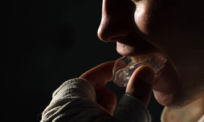 東京都港区青山の歯医者 マウスガードとは