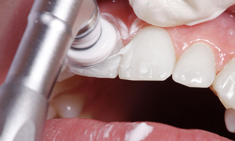 東京都港区青山の歯医者 無痛治療について